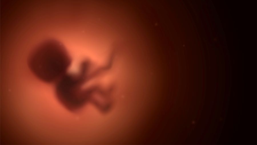 έκτρωση άμβλωση